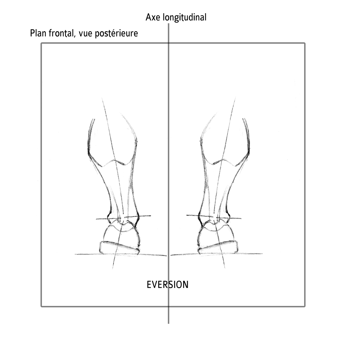 Over Pronation